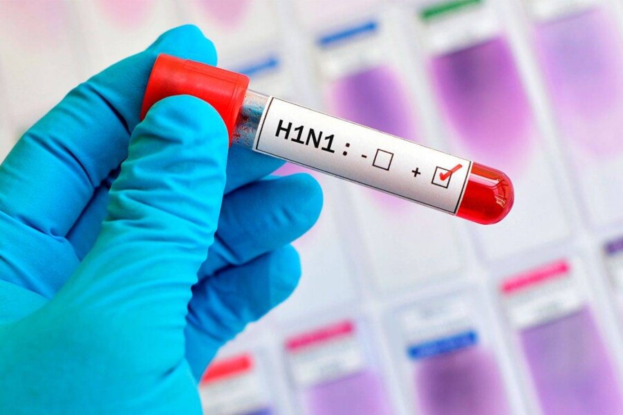 confirmado-primeiro-caso-de-h1n1-de-frederico-westphalen