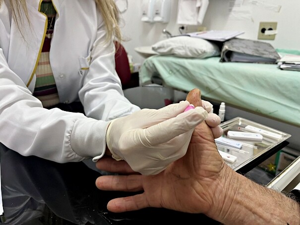 secretaria-da-saude-conclui-mes-de-combate-as-hepatites-virais-com-350-testes-realizados